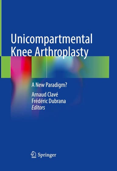 Image of - Unicompartmental Knee Arthroplasty A New Paradigm? | Hardcover