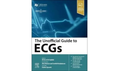 Image of - The Unofficial Guide To Ecgs With Access Code | Paperback