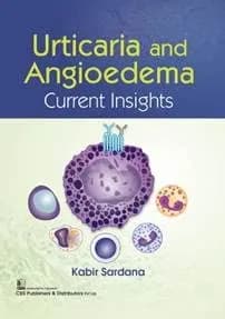 Image of - Urticaria And Angioedema Current Insights | Paperback