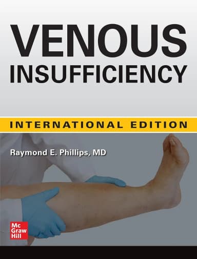 Image of - Venous Insufficiency (Ie) | Hardcover