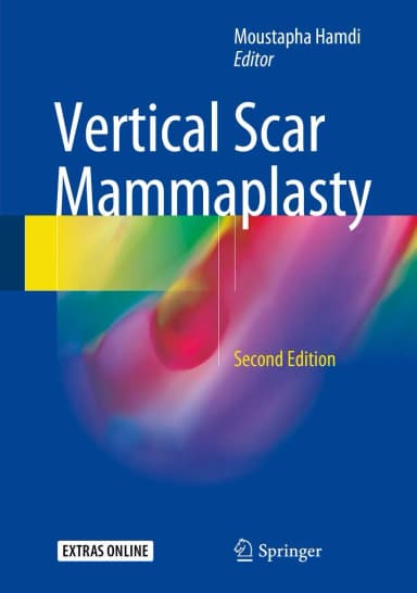 Image of - Vertical Scar Mammaplasty | 2nd Edition | Hardcover