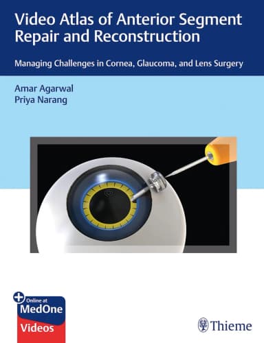 Image of - Video Atlas of Anterior Segment Repair and Reconstruction | Paperback