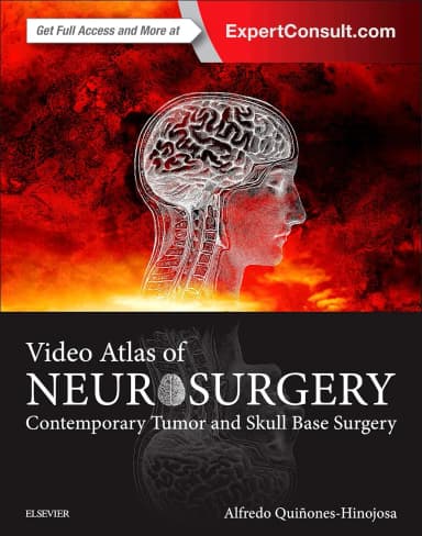 Image of - Video Atlas of Neurosurgery Contemporary Tumor and Skull Base Surgery | Hardcover
