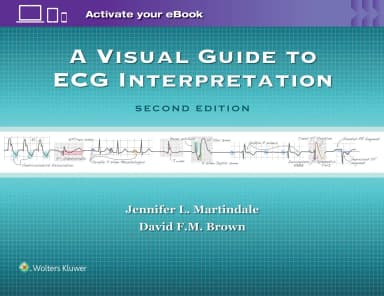Image of - A Visual Guide to ECG Interpretation | 2nd Edition | Paperback