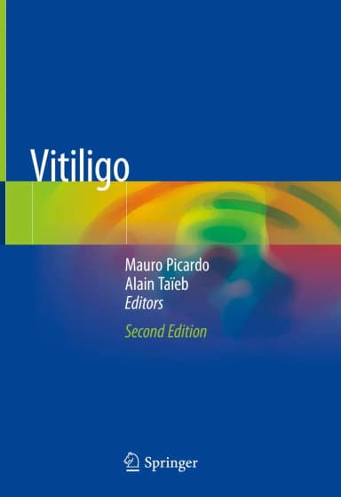 Image of - Vitiligo | 2nd Edition | Hardcover