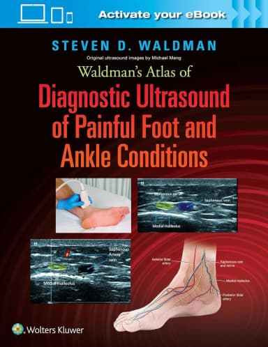 Image of - Waldman's Atlas of Diagnostic Ultrasound of Painful Foot and Ankle Conditions | Hardcover