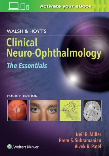 Image of - Walsh And Hoyts Clinical Neuro Opthalmology The Essentials | 4th Edition | Paperback