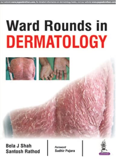 Image of - Ward Rounds In Dermatology | Paperback