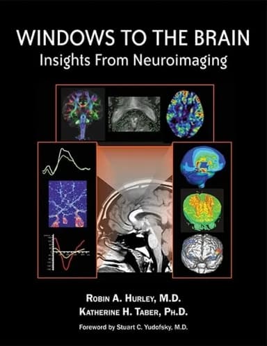 Image of - Windows to the Brain Insights from Neuroimaging | Hardcover