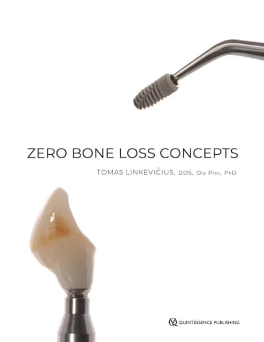 Image of - Zero Bone Loss Concepts | Hardcover