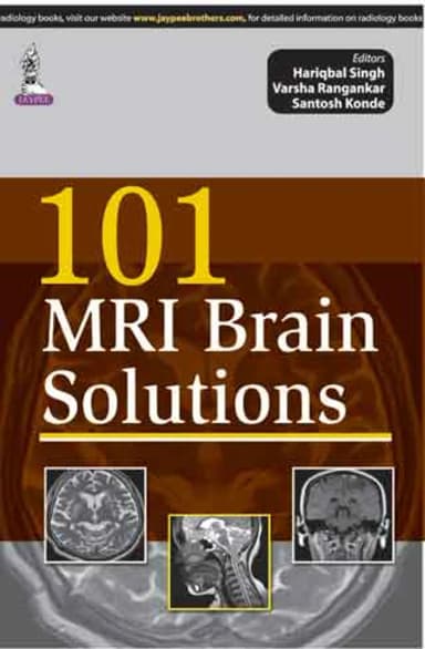 Image of - 101 MRI Brain Solutions