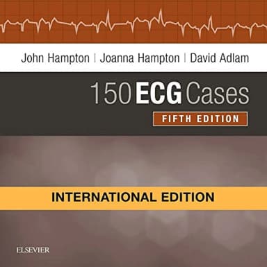 Image of - 150 ECG Cases(IE) -5E