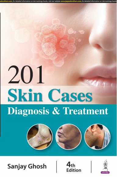 Image of - 201 Skin Cases Diagnosis & Treatment