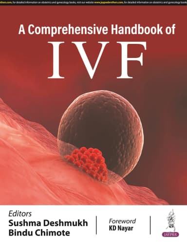 Image of - A Comprehensive Handbook of IVF