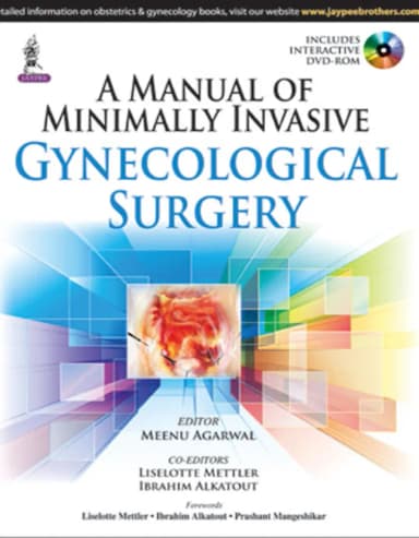 Image of - A Manual of Minimally Invasive Gynecological Surgery
