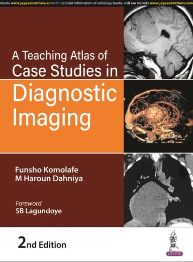 Image of - A Teaching Atlas of Case Studies in Diagnostic Imaging