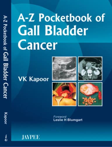 Image of - A-Z Pocketbook of Gall Bladder Cancer - 1st Edition 2010