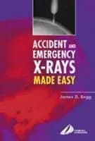 Accnt and Emergency X-Rays Made Easy - 1st Edition
