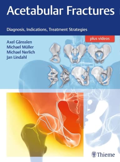 Image of - Acetabular Fractures 1st Edition