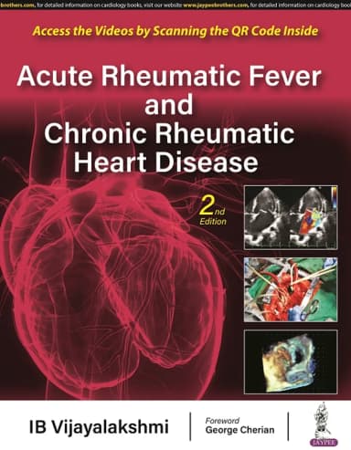 Image of - Acute Rheumatic Fever and Chronic Rheumatic Heart Disease