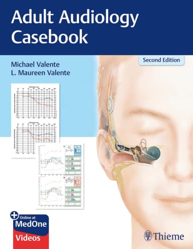 Image of - Adult Audiology Casebook 2nd Edition