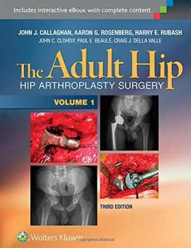 Image of - The Adult Hip (Two Volume Set): Hip Arthroplasty Surgery | 3rd Edition