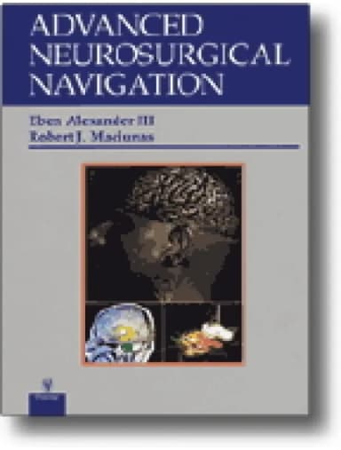 Image of - Advanced Neurosurgical Navigation - 1st Edition