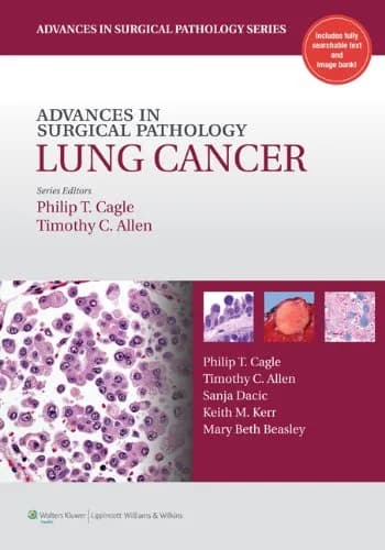 Image of - Advanced Surgical Pathology Lung Cancer - 1st Edition
