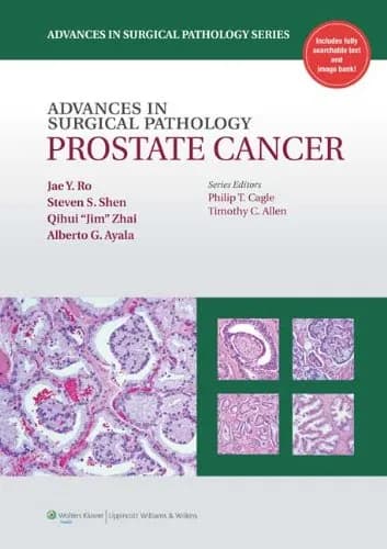 Image of - Advances in Surgical Pathology: Prostate Cancer