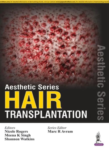 Image of - Aesthetic Series-Hair Transplantation