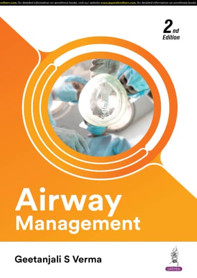 Image of - Airway Management