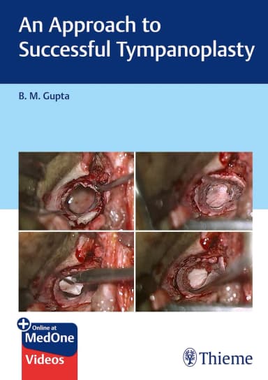 Image of - An Approach to Successful Tympanoplasty 1st Ed.