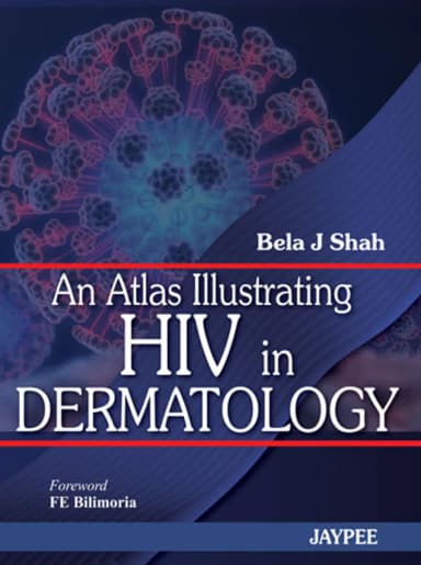 Image of - An Atlas Illustrating HIV in Dermatology