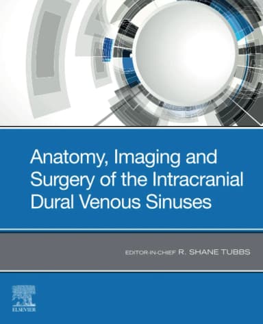 Image of - Anatomy, Imaging and Surgery of the Intracranial Dural Venous Sinuses-1E