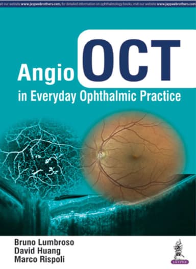 Image of - Angio OCT in Everyday Ophthalmic Practice