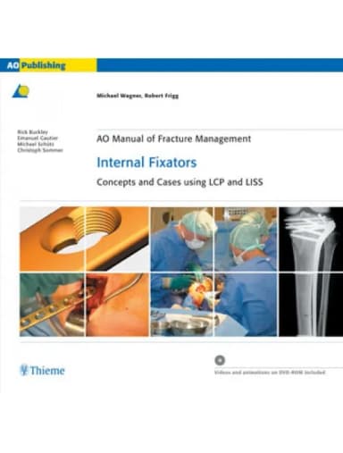 Image of - AO Manual of Fracture Management Internal Fixators - 1st Edition Indian Reprint