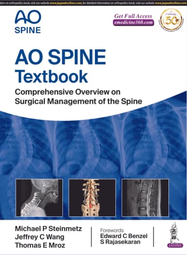 Image of - AO Spine Textbook | Comprehensive Overview on Surgical Management of the Spine