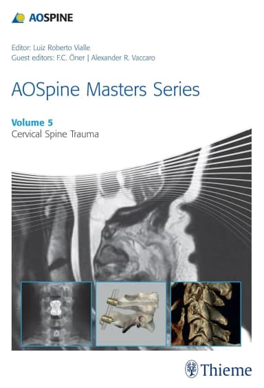 Image of - AOSpine Masters Series, Volume 5: Cervical Spine Trauma 
