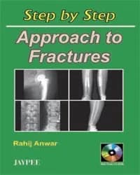approach-to-fractures-1st-edition