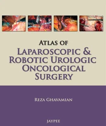Image of - Atlas of Laparoscopic and Robotic Urologic Oncological Surgery - 1st Edition