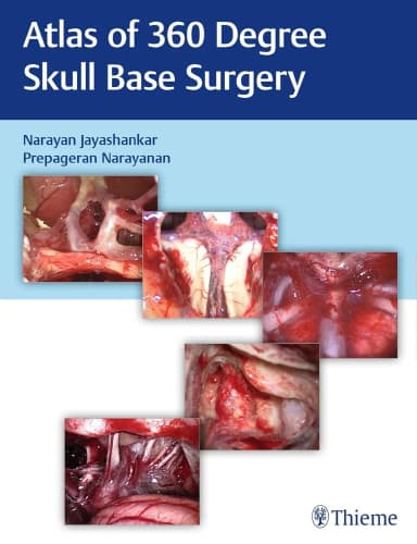 Image of - Atlas of 360 Degree Skull Base Surgery 1st Ed.
