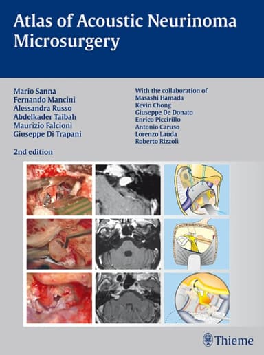 Image of - Atlas of Acoustic Neurinoma Microsurgery