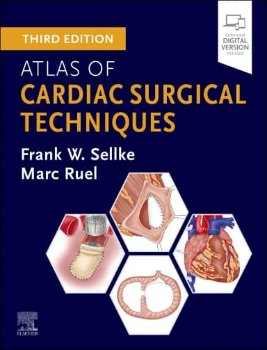 Image of - Atlas of Cardiac Surgical Techniques - 3E