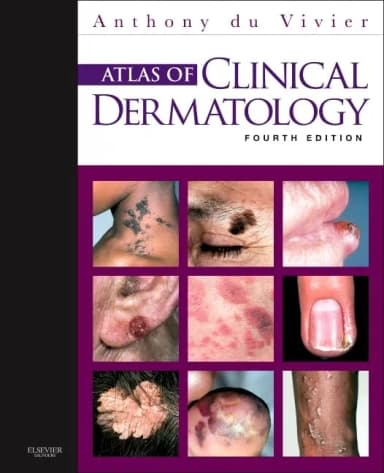 Image of - Atlas of Clinical Dermatology 4/e