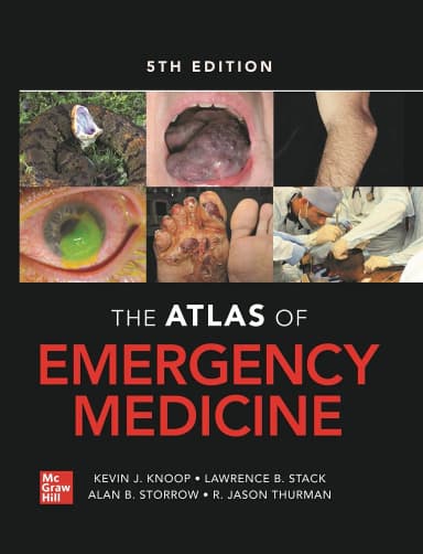 Image of - Atlas of Emergency Medicine(IE)-5E