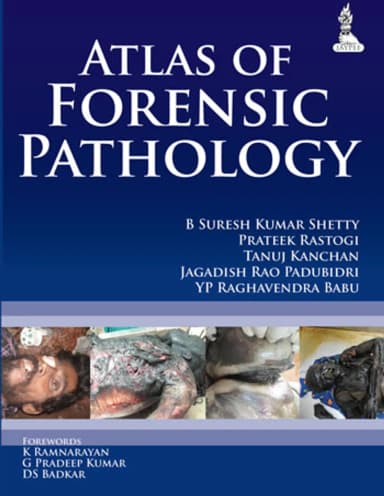 Image of - Atlas of Forensic Pathology