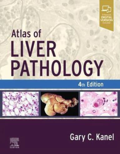 Image of - Atlas of Liver Pathology - 4E