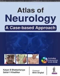 Image of - ATLAS OF NEUROLOGY A CASE BASED APPROACH