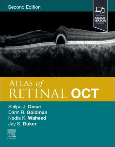 Image of - Atlas of Retinal OCT: Optical Coherence Tomography - 2E