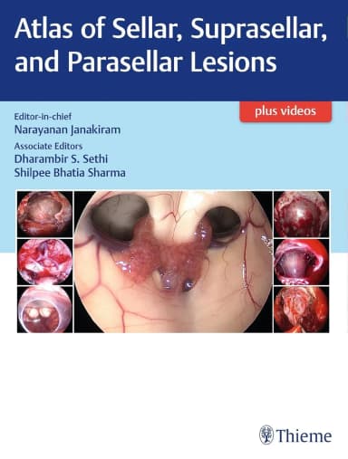 Image of - Atlas of Sellar, Suprasellar, and Parasellar Lesions 1st Ed.